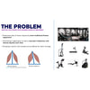 The Problem: sagittal pain points with modern pieces of equipment. Predominant plane of motion executed by most traditional fitness equipment. Overtraining in sagittal plan can lead to muscular imbalances and chronic injuries over time. Prompting a need for more versatile and cost-effective for clients of all ages.